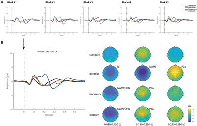 Tracking auditory mismatch negativity responses during full conscious state and coma